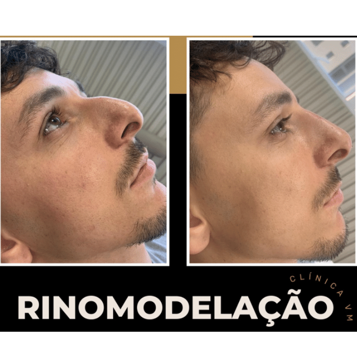 Design sem nome (11)